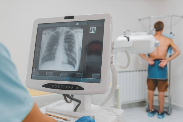 Digital X-ray equipment